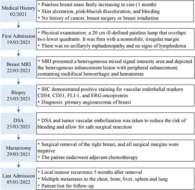 Primary breast angiosarcoma: A case report